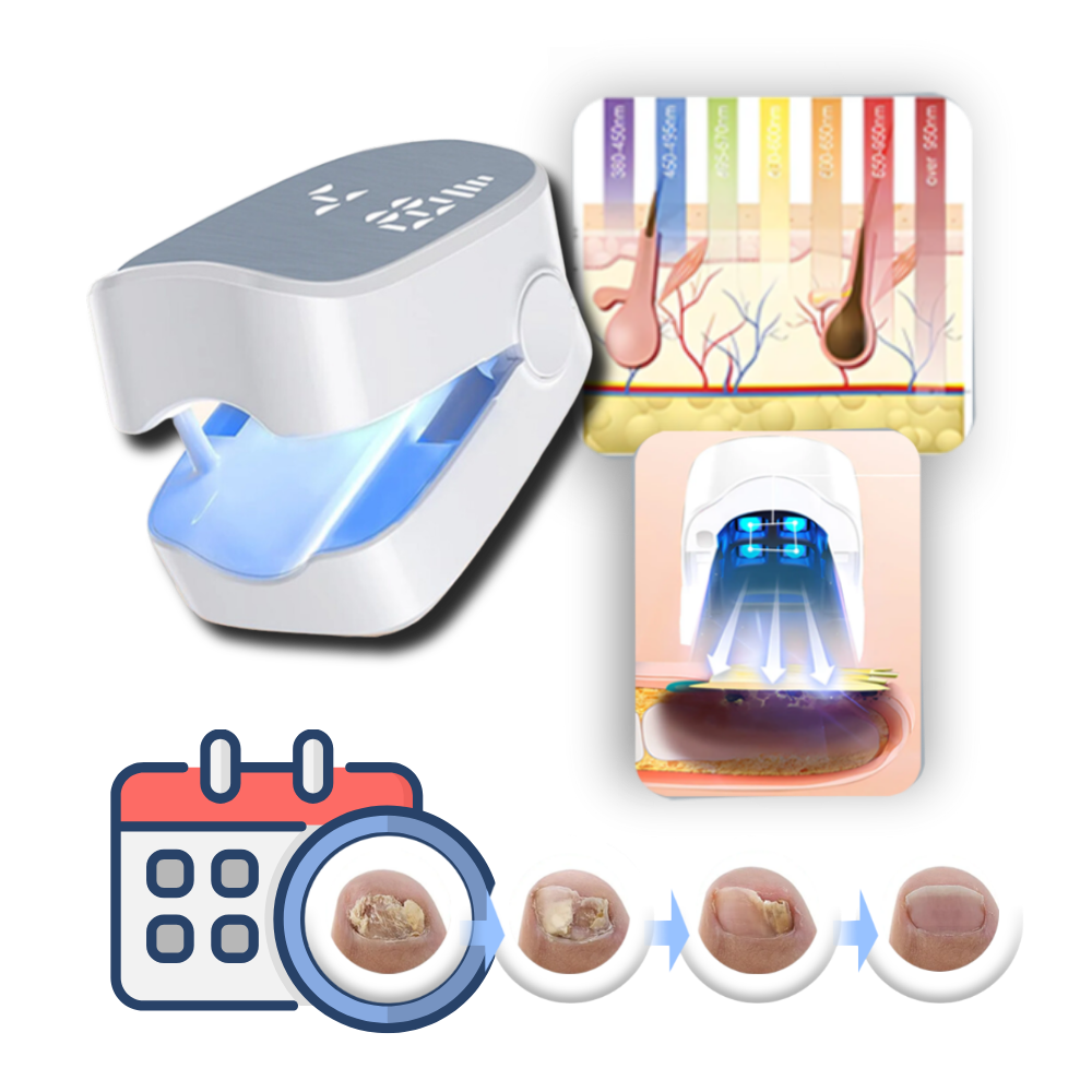 Laser Nail Treatment Device with Dual Cold Laser and Blue Light, Clip-On Design