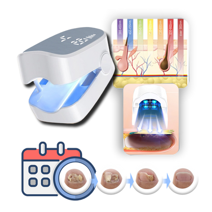 Laser Nail Treatment Device with Dual Cold Laser and Blue Light, Clip-On Design
