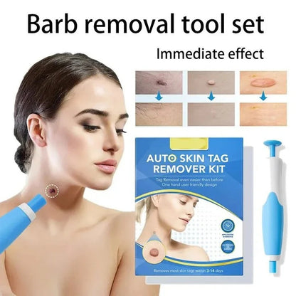 Skin Tag Removal Kit with Dual Head Pen and 40 Silicone Bands