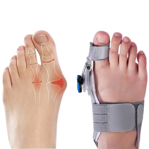 Adjustable Bunion Corrector with Hinge Joint and Silicone Padding, Universal Size
